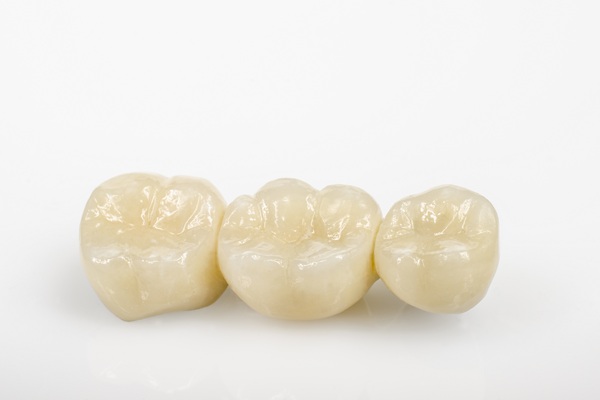 Dental Bridge Vs  Implants: Which Tooth Replacement Option Is Right For You?