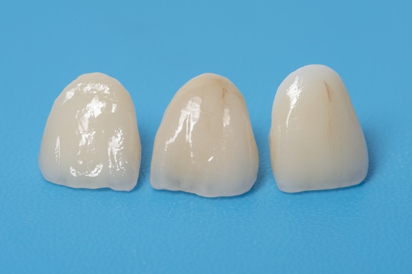 Cosmetic Dentistry Options With Dental Crowns
