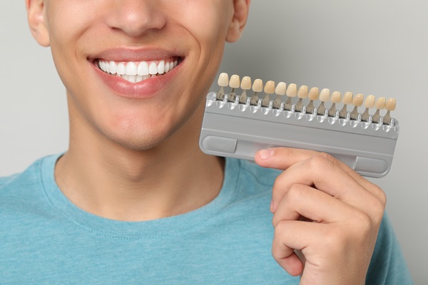 Smile Makeover With Dental Veneers