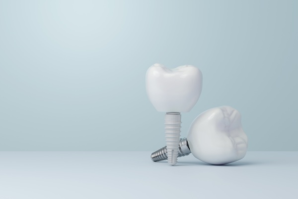 Implant Crowns Vs  Traditional Crowns: Key Differences Explained
