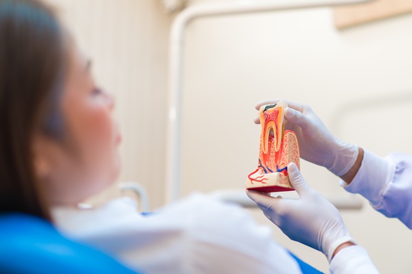 Important Information About Root Canal Therapy